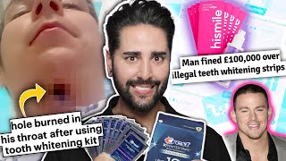 Tooth Whitening Kit Left A Hole In His Throat! 😭 - When Beauty Turns Ugly 💜 James Welsh