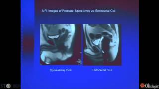 MRI in Oncology - 2012 - by W. Brian Hyslop, MD, PhD