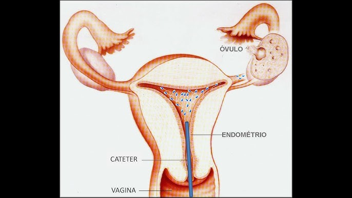 Mobil telefonda yozgi lagerda jinsiy aloqa