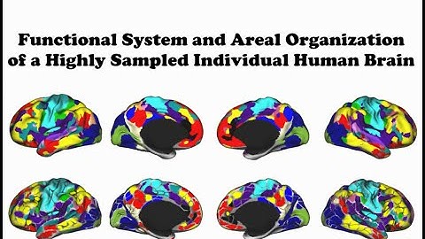 Functional Organization of an Individual Human Brain
