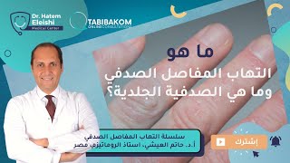 الصدفية والتهاب المفاصل الصدفي . أ.د.حاتم العيشي