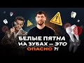 Что за белые пятна у вас на зубах? Отвечает стоматолог 🦷