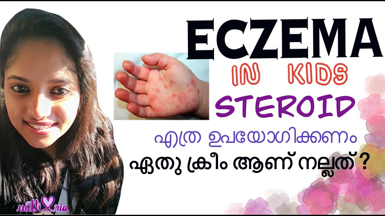 Eczema skin care Moisturizers for kids How to use steroid for