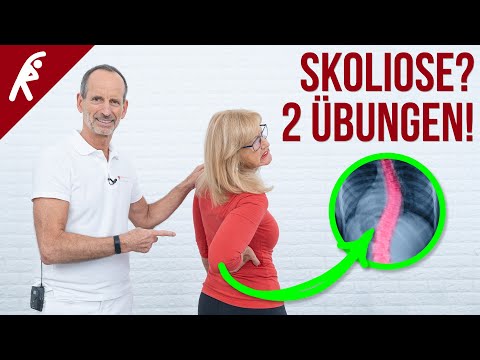 Video: Ungleichmäßige Schultern: Skoliose, Übungen, Behandlungen Und Mehr