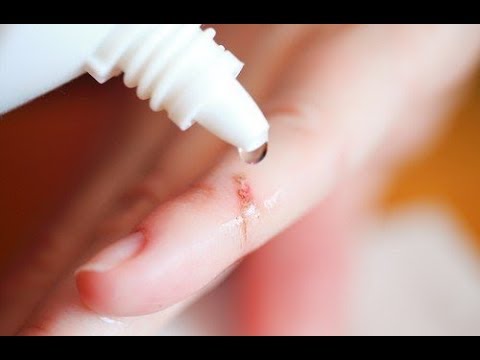 Vidéo: Cueillir Des Croûtes: Comment Arrêter La Cueillette Compulsive Et Guérir Les Cicatrices
