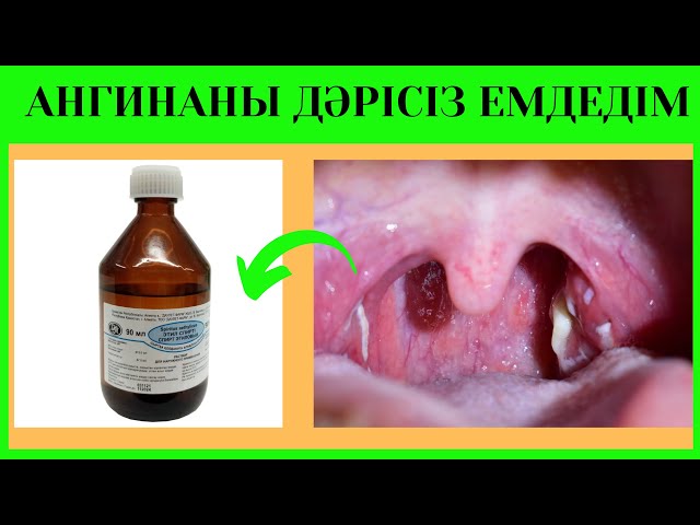 Кешігу болды, бірақ жыныстық қатынас болмады, мастурбация болды.