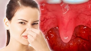12 SUPRISING DAILY DO'S AND DON'TS TO AVOID BAD BREATH