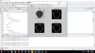 Pengolahan Citra: Deteksi Tepi Laplacian pada Matlab