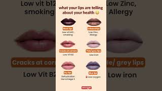 What Your Lips Are Telling You About Your Health | improve health |
