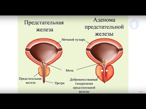 Роль простаты в организме мужчины / Здравствуйте