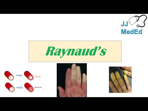 Introduction to Raynaud’s Phenomenon (Syndrome) | Pathophysiology, Triggers, Symptoms, Treatment