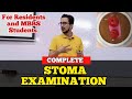 Complete Stoma Examination For Osce & Wards | For Residents and MBBS students
