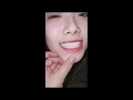 颜值高高的美女展示嘴巴牙齿口腔 全套Q2503736638 颜值高高的美女展示嘴巴牙齿口腔 全套Q2503736638
