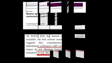 To what size will you enlarge the canal in cases with lesions | Narrow vs Larger apical preparation