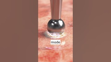 Do you know how forcedCOAG in electrosurgery works? #MedTech #education #science #coagulation