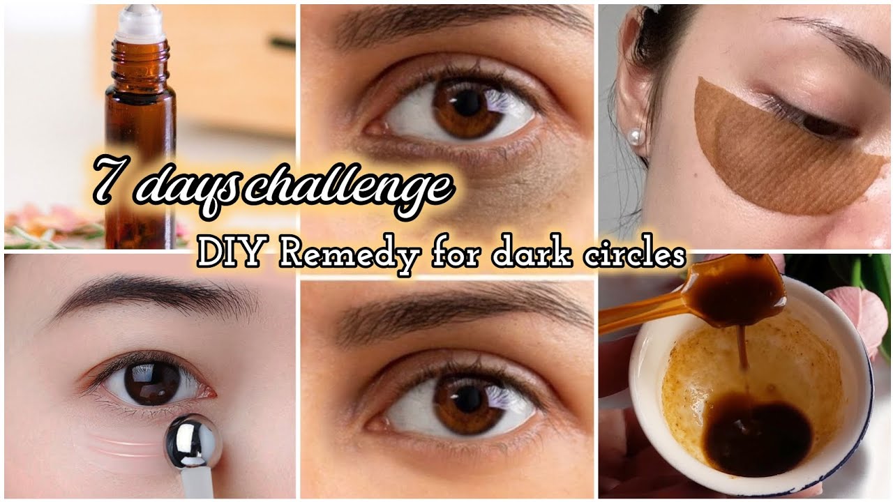 Transform Your Eyes: 7 Day Dark Circles Removal Challenge!