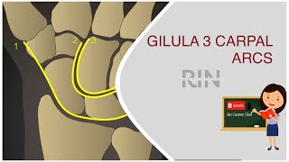 GILULA 3 CARPAL ARCS @easypeasyrad