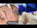 Most Extreme Beauty Treatments 2021 Best Smart and Helpful Beauty Hacks | Virtual Beauty