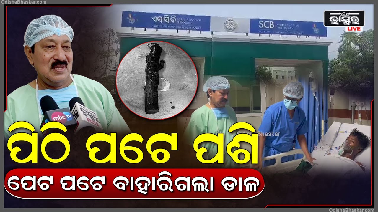 ପିଠି ପଟେ ପଶି ପେଟ ପଟେ ବାହାରିଥିଲା ଡାଳ ଏବେ SCB ରେ ଯୁବକଙ୍କର ହେଲା ସଫଳ ଅସ୍ତ୍ରୋପଚାର