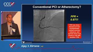 Imaging in PCIOverratedAjay j  Kirtane, MD