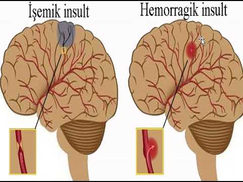 Patoloji anatomiya-1 - 4-cü mühazirə - Qan və limfa dövranı pozulmaları