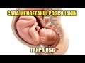 Cara Mengetahui Posisi Janin tanpa USG