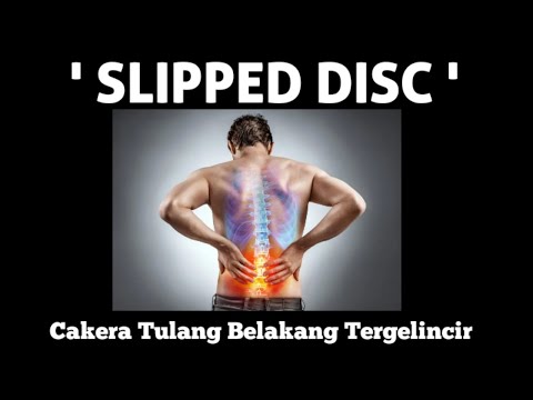 SLIPPED DISC (CAKERA TULANG BELAKANG TERGELINCIR) - SIMPTOM, PUNCA & RAWATAN