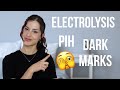 DARK MARKS AFTER ELECTROLYSIS HAIR REMOVAL | POST INFLAMMATORY HYPER-PIGMENTATION