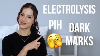 DARK MARKS AFTER ELECTROLYSIS HAIR REMOVAL | POST INFLAMMATORY HYPERPIGMENTATION