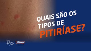 Quais são os TIPOS de PITIRÍASE? | Dicas de Saúde