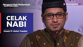 Mengenal Nabi Muhammad (11) : Celak Nabi - Ustadz M Abduh Tuasikal