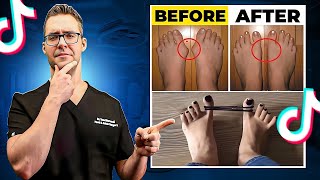 Doctor Reacts to the Most Shocking Foot Transformations on TikTok