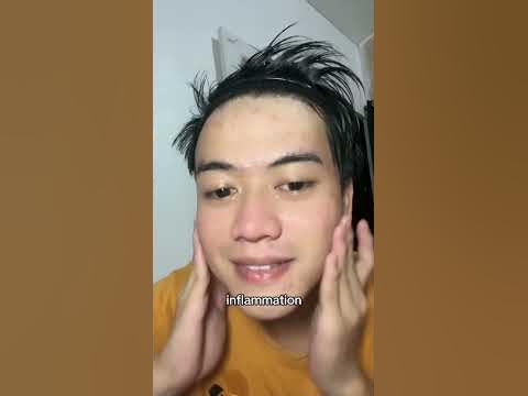 (SALICYLIC ACID) Acne Treatment Ice Sleep Masque - YouTube