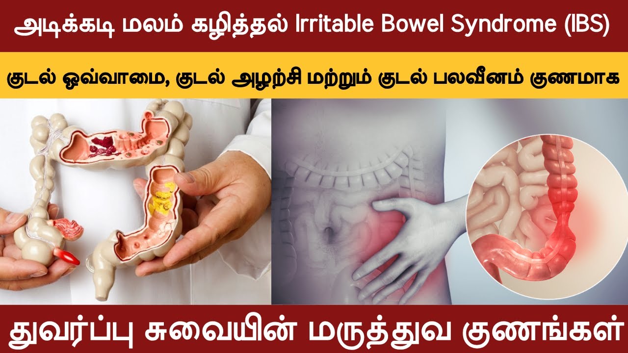அடிக்கடி மலம் கழித்தல் குணமாக | Irritable Bowel Syndrome (IBS) | குடல் ஒவ்வாமை | தயிர் சுண்டி சூரணம்