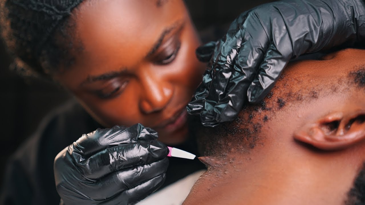 ASMR Intense Beard Scratching & Neck Massage (Ingrown Hair Removal + Nitpicking)4 Deep Sleep. No Gum