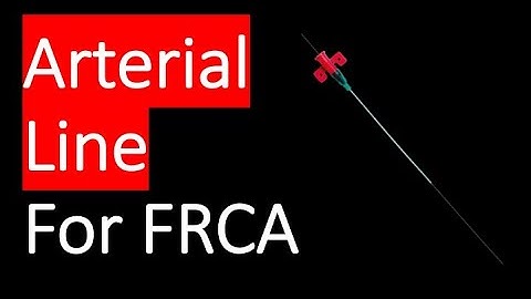 The arterial line EXPLAINED