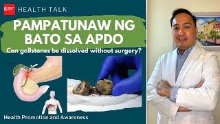 Pampatunaw ng bato sa Apdo (Can gallstones be dissolved without surgery?)