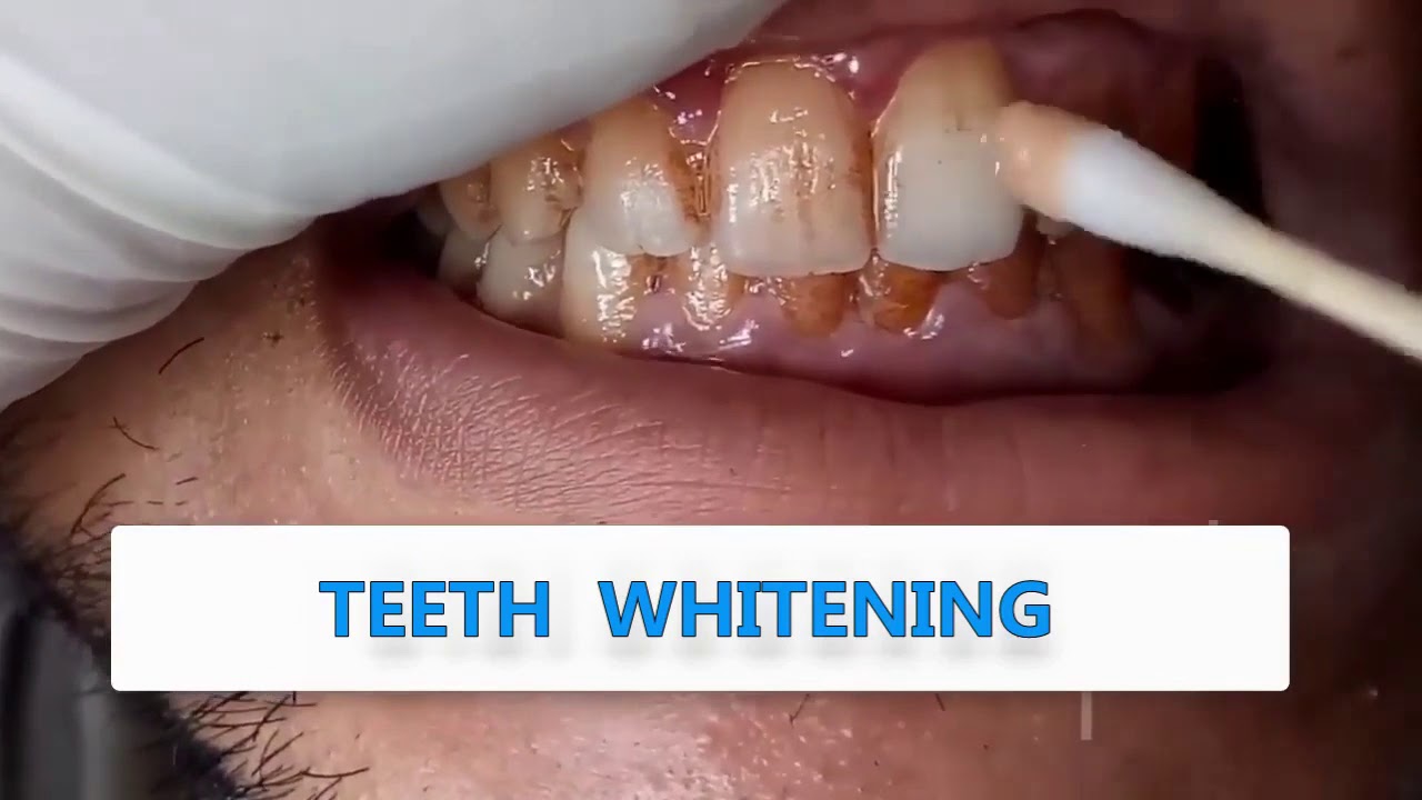 Lanbena   Pettah Kade