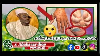 TAWFÉKH?Ndokhoum Siti Dermatoses ou Maladies de la peau soigner le ndoxum sity s.Ababacar diop