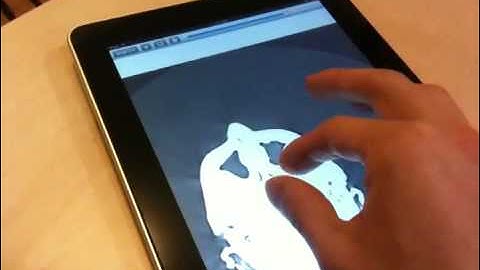 DICOM Viewer iPad