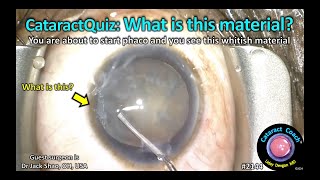 CataractCoach™ 2144: CataractQuiz: What is this material?