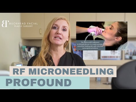 Profound Skin Tightening Treatment (Everything you need to know)