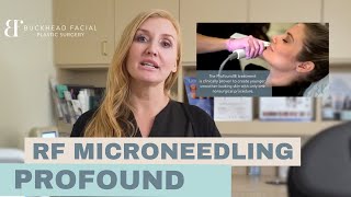 Profound Skin Tightening Treatment (Everything you need to know)