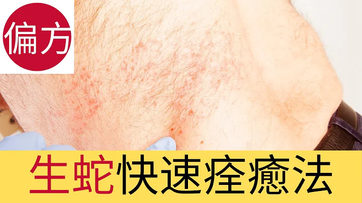生蛇快速痊癒法 - 天天要聞