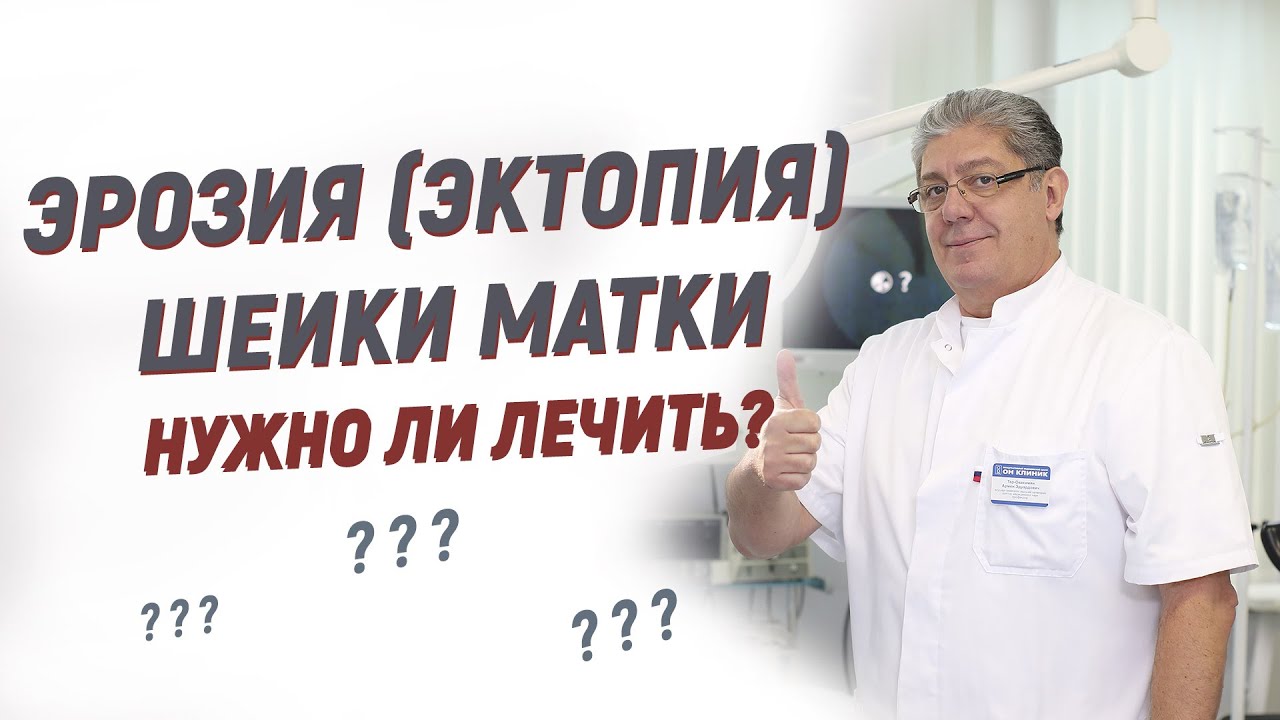Эрозия (эктопия) шейки матки: нужно ли лечить? - YouTube