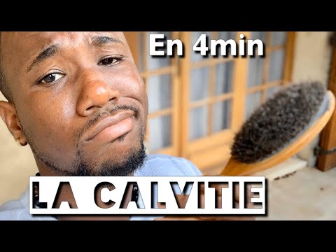 Vidéo: Alopécie (calvitie) Chez L'homme - Comment Arrêter La Calvitie? Préparations, Shampooings