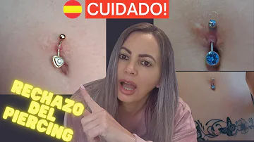 ¿Qué ocurre cuando el cuerpo rechaza un piercing?