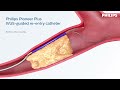 Identify true lumen - Philips Pioneer Plus IVUS-guided Re-entry Catheter