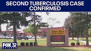 Second tuberculosis case confirmed at suburban Chicago high school, expert weighs in