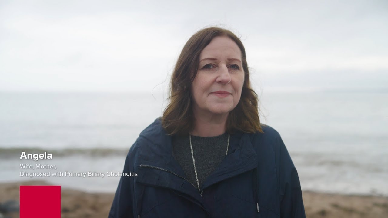 Beyond the diagnosis: Angela’s journey living with PBC
